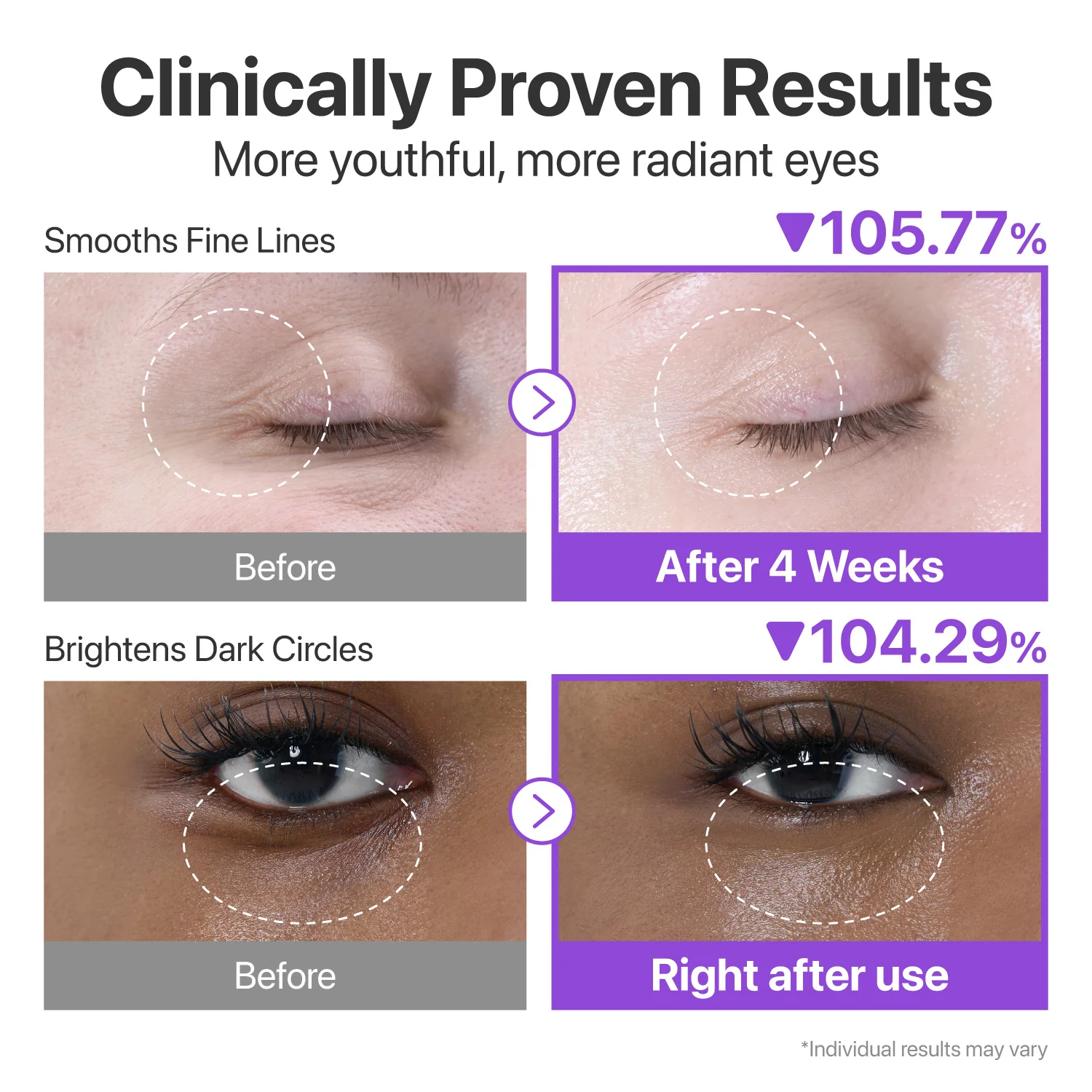 Daily Eye Care Duo - Image 4
