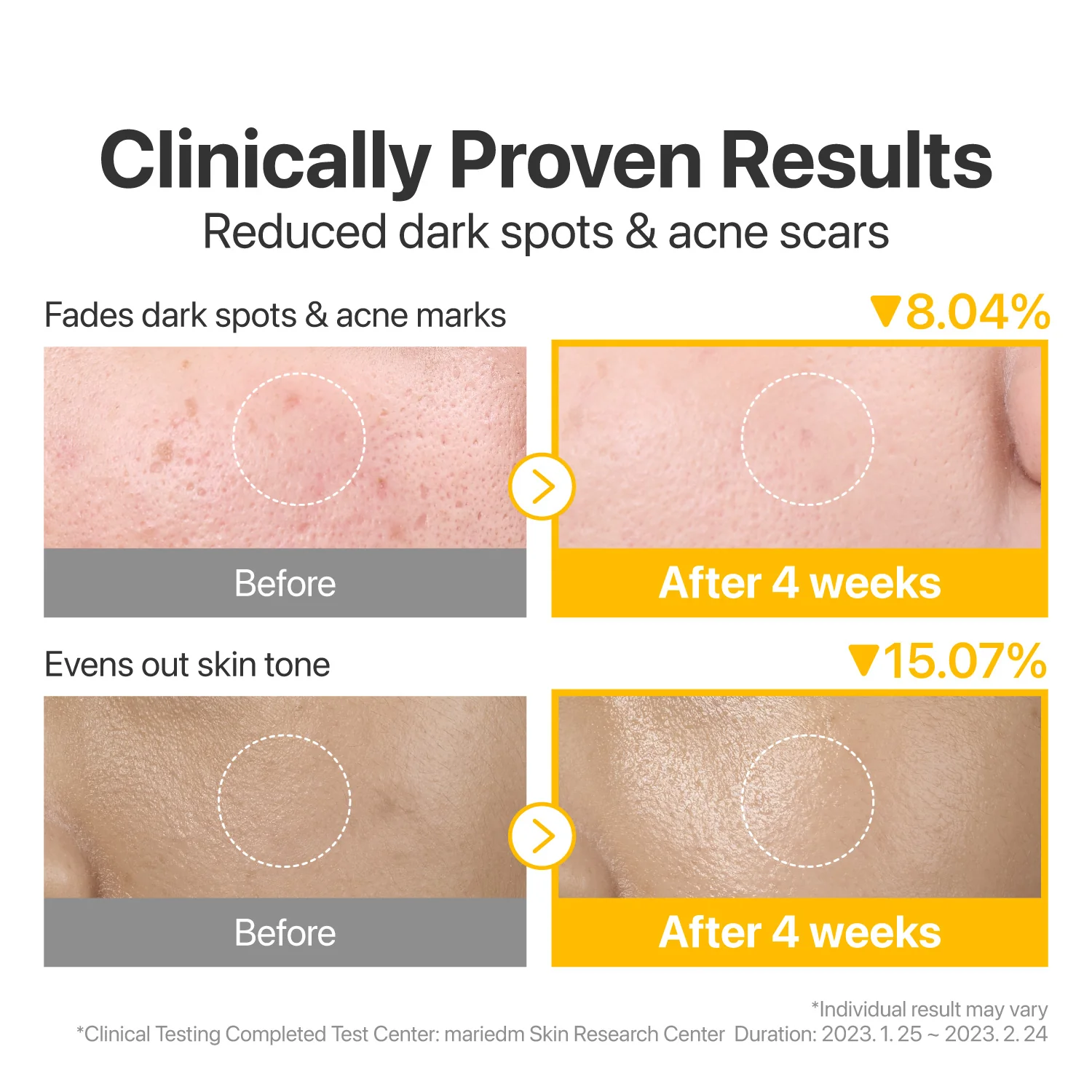 No.5 Vitamin-Niacinamide Concentrated Toner Pads - Image 5