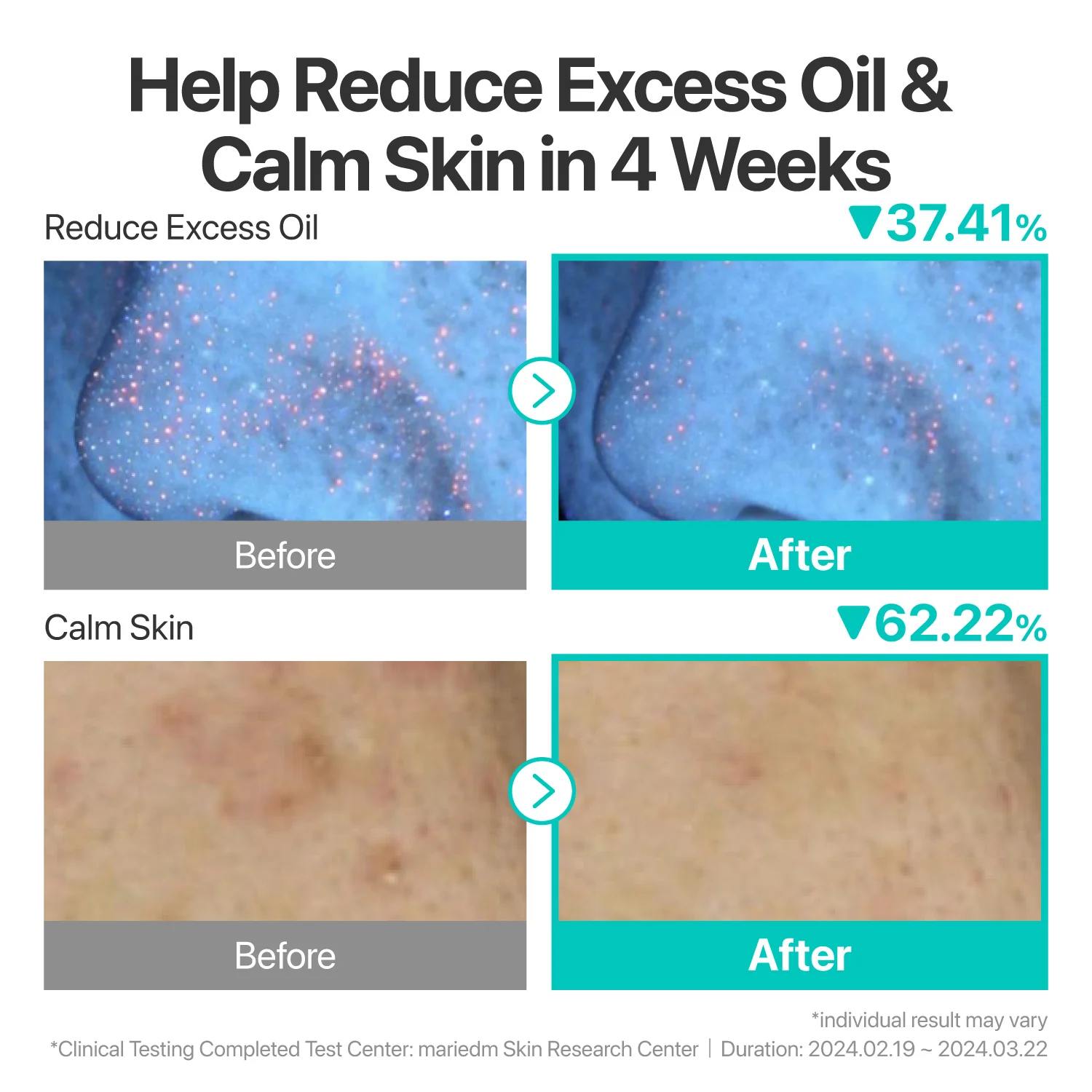 No.1 SOS Clear Skin Rescue Trio - Image 6