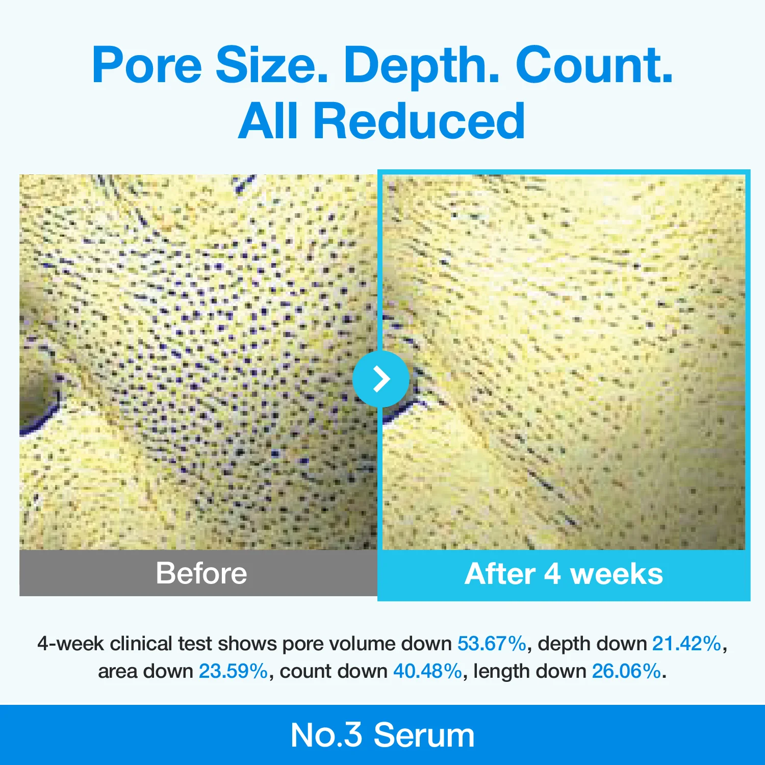 No.3 Blue Bio-Retinol Pore Refining Serum Mini Kit (1.3ml*10EA) - Image 4