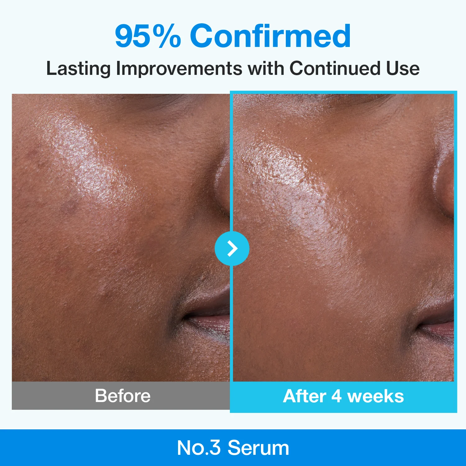 No.3 Blue Bio-Retinol Pore Refining Serum Mini Kit (1.3ml*10EA) - Image 5