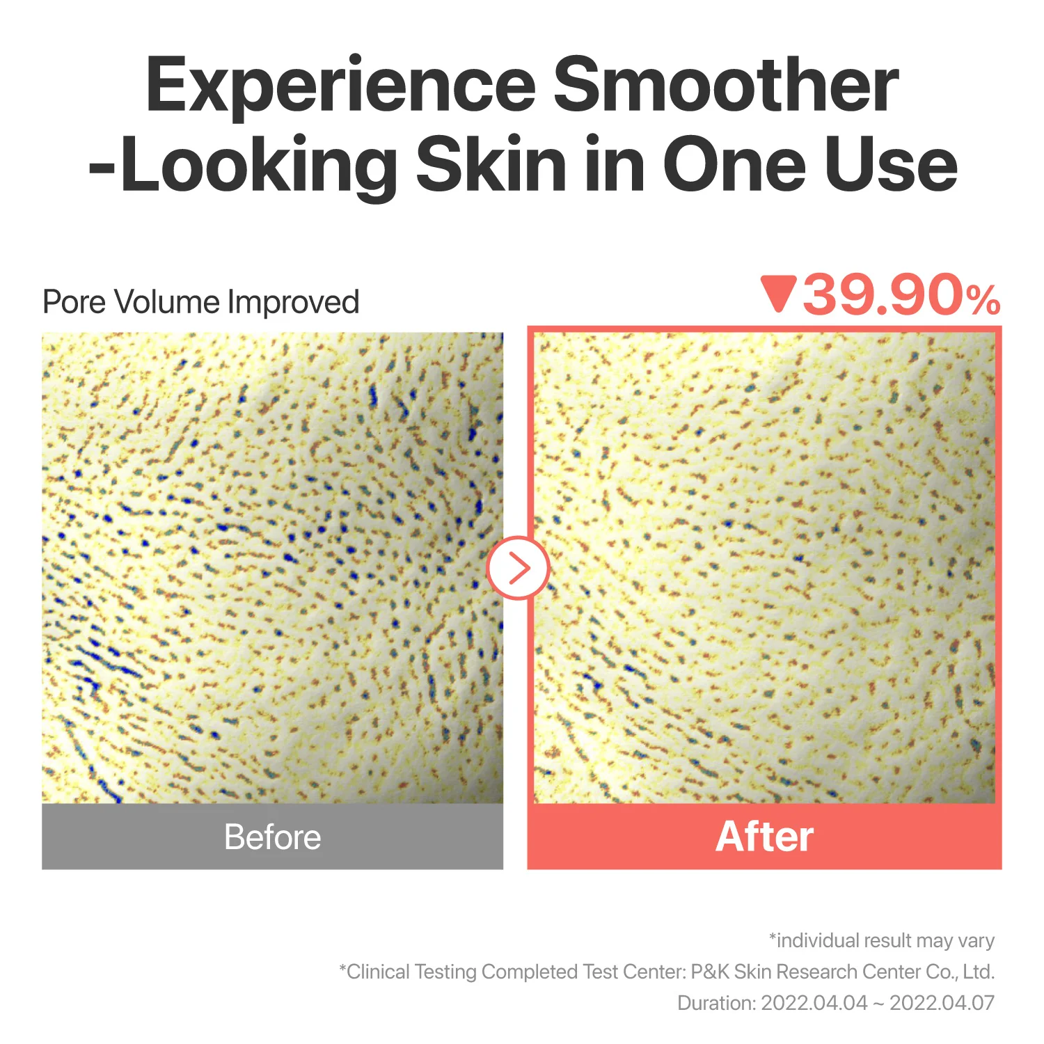 No.3 Tingle-Pore Softening Sheet Mask (5 Sheets) - Image 5