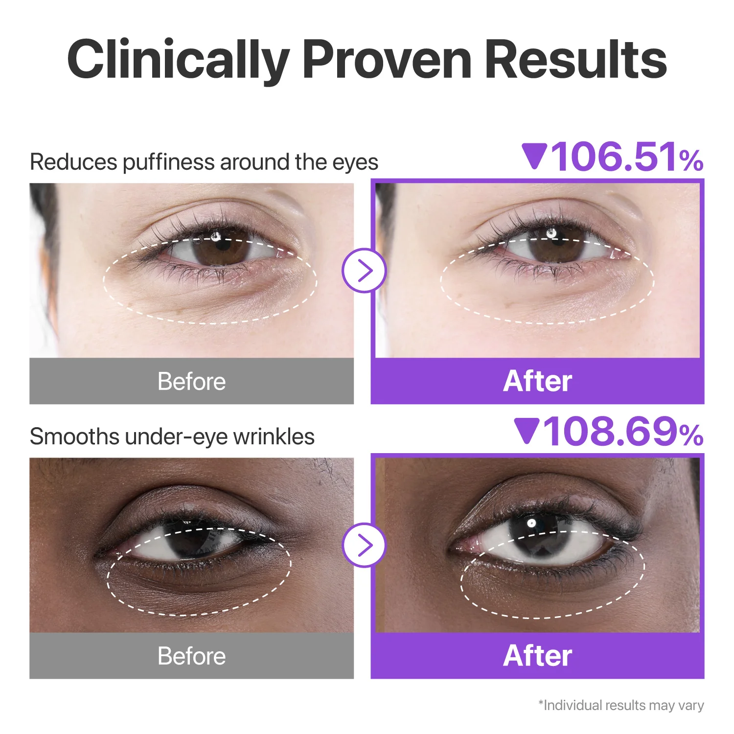 No.9 NAD+ Collagen Under Eye Patches (5 Pairs) - Image 4