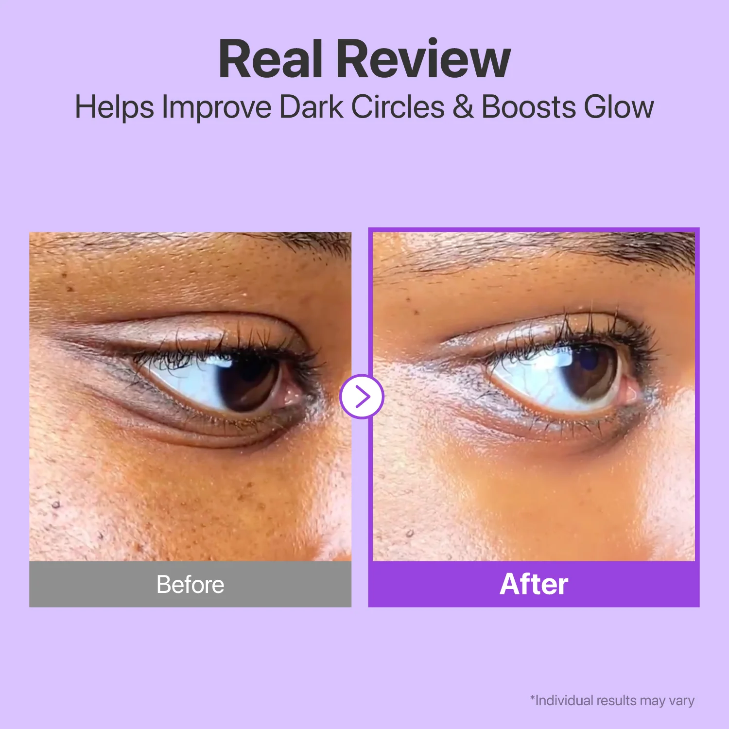 No.9 NAD+ Retinol Volumetox Eye Cream - Image 6