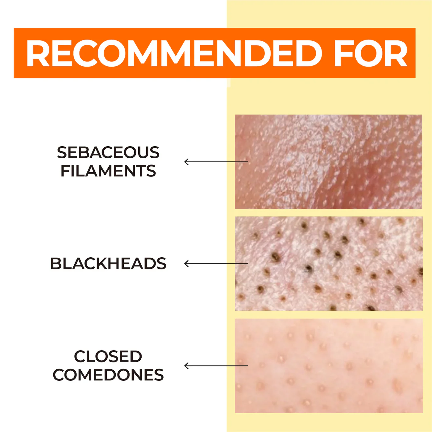 Pore Tightening Routine Set - Image 5