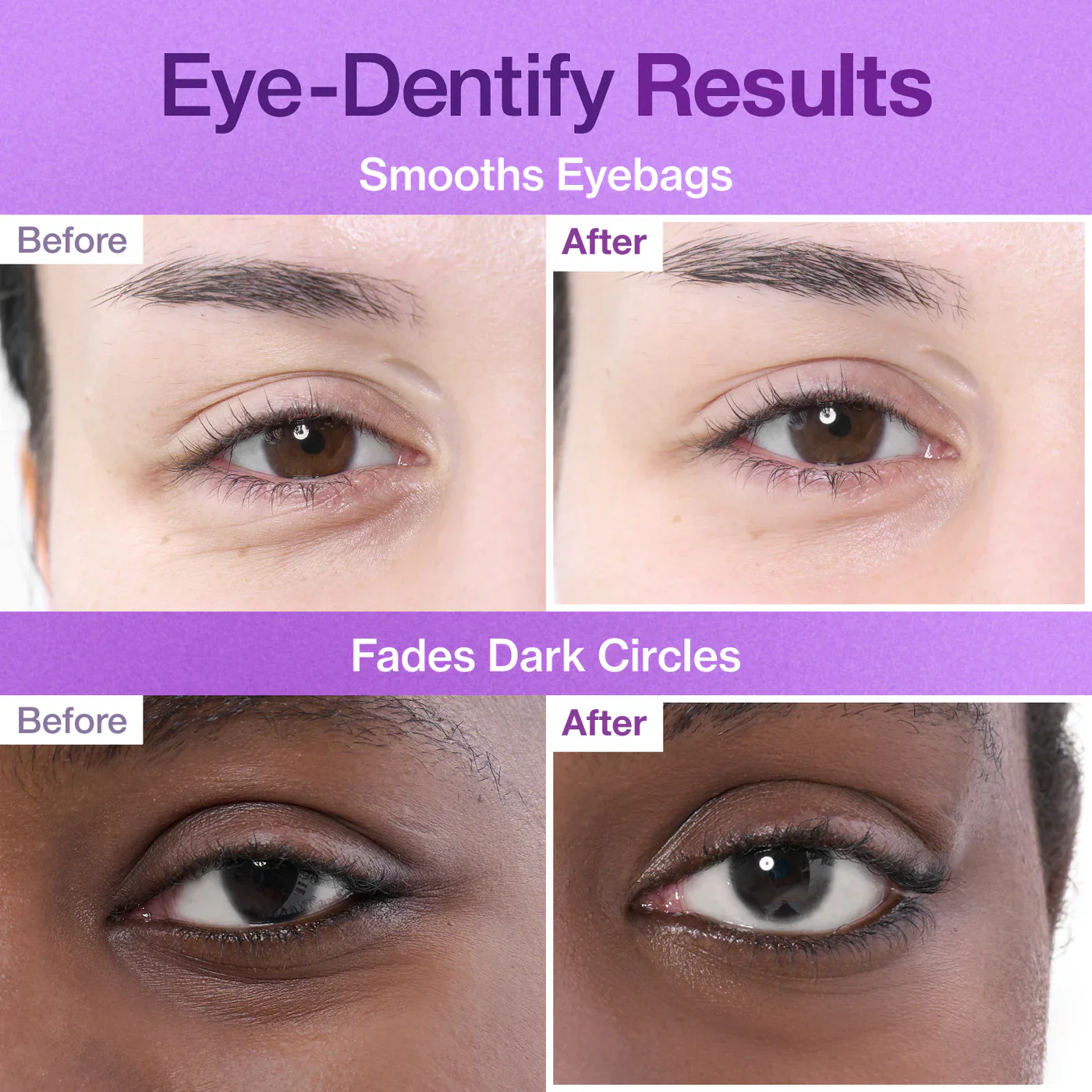 Special Eye Treatment Set - Image 11